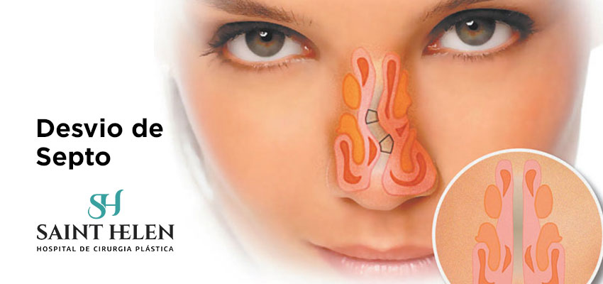 desvio-de-septo-cirurgia