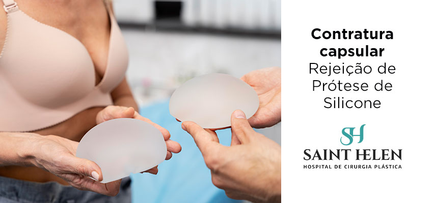 contratura-capsular-protese-silicone