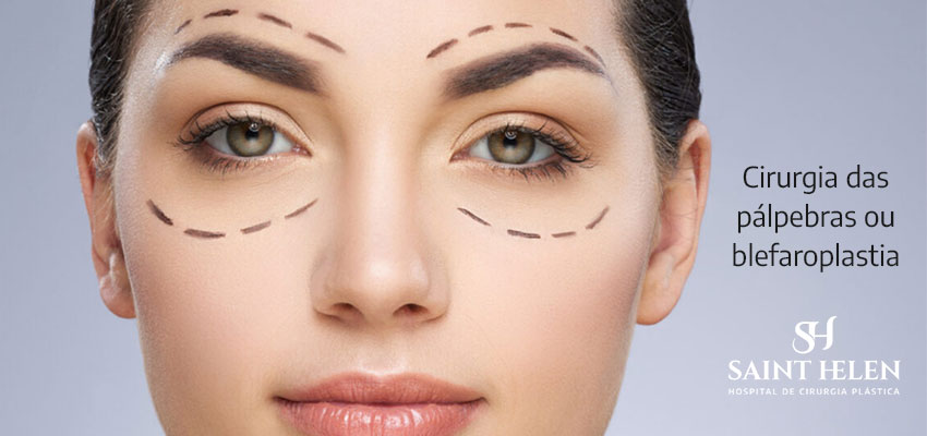 cirurgia-palpebras-ou-blefaroplastia