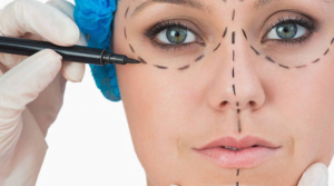 mitos-cirurgia-plastica