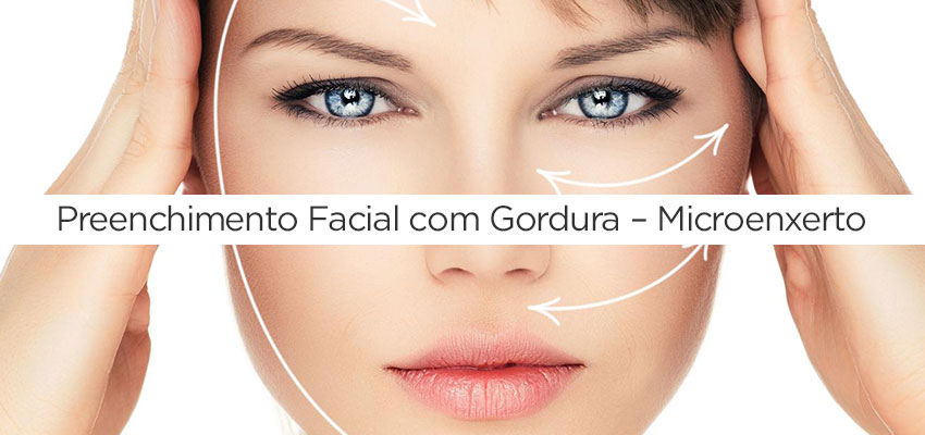 preenchimento-facial-com-gordura