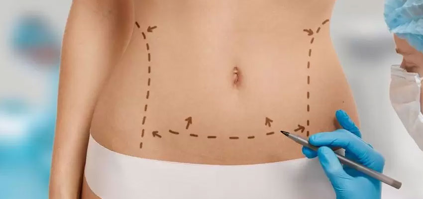 dreno-cirurgia-plastica