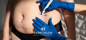 cirurgia-plastica-abdomen