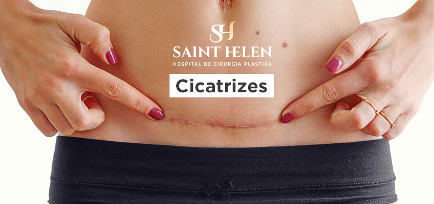 estudo-sobre-cicatrizes